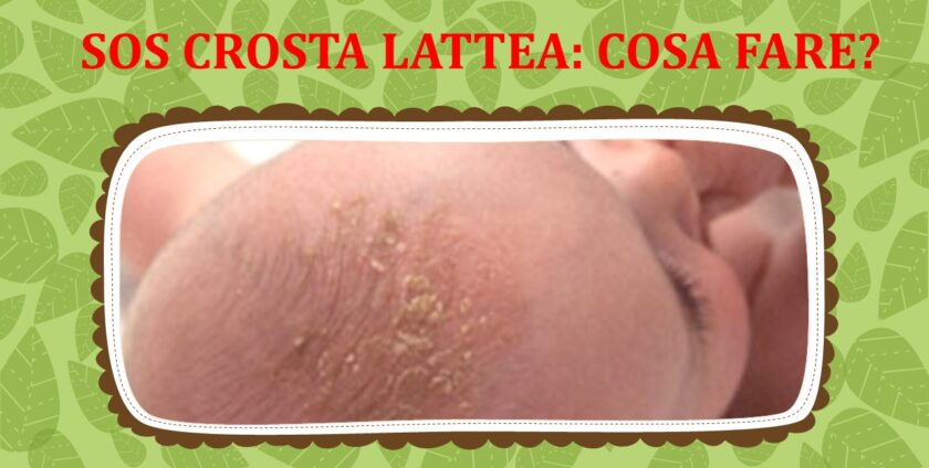 crosta testa neonato