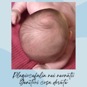 osteopata infantile roma plagiocefalia